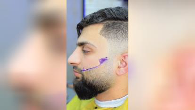 اصلاح صورت جدید