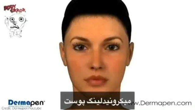 میکرومیدلینگ پوست