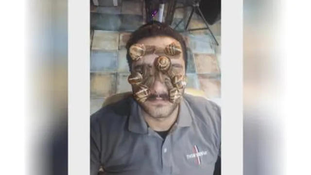 حلزون تراپ ی
