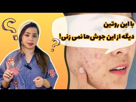 راهکارهای درمان جوش زیرپوستی سفت و دردناک | روش‌های حرفه‌ای مراقبت از پوست با توجه به تغییرات هورمونی
