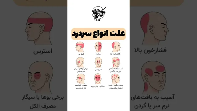 چرا سردرد می‌گیریم؟ آشنایی با انواع و علل سردرد