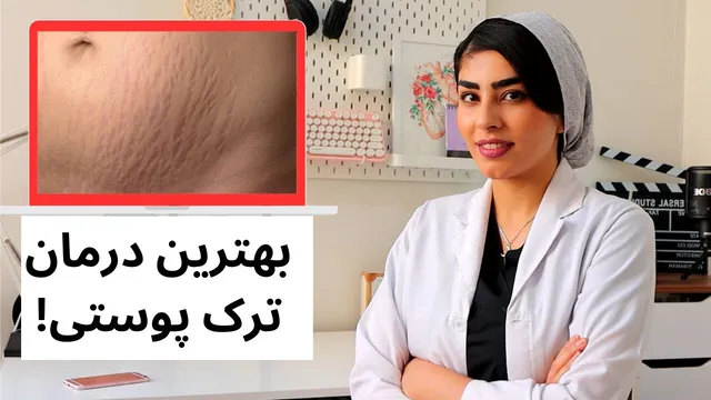چطور از شر ترک‌های پوستی خلاص شویم؟ نکات و راهکارهای متخصص پوست