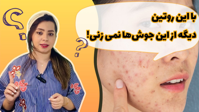 درمان جوش‌های دردناک زیرپوستی | روتین حرفه‌ای مراقبت از پوست با توجه به تغییرات هورمونی