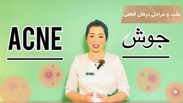 راهنمای جامع درمان پوست چرب و جوشدار: چگونه به طور قطعی جوش صورت و آکنه را درمان کنیم؟