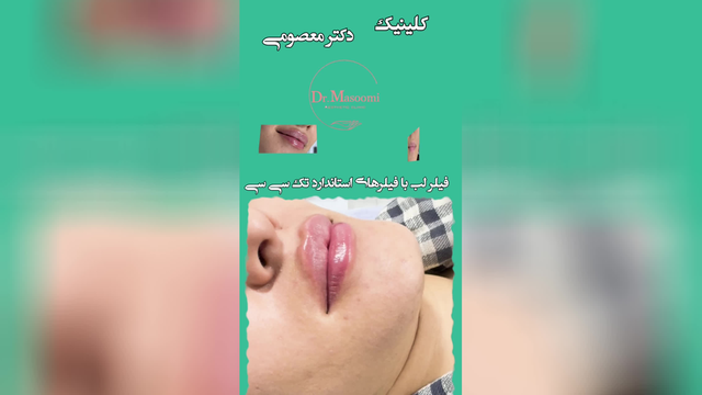 کلینیک زیبایی شاهین دژ
