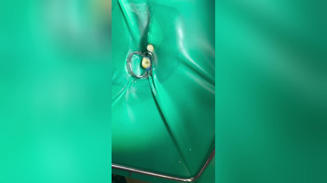 متخصص جراحی و درمان ریشه در ساوه