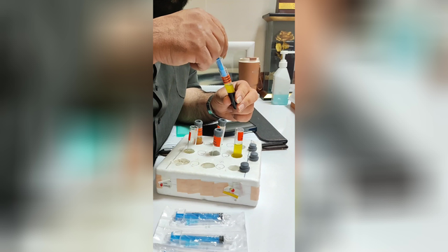 آموزش PRP (متمم_زخم)