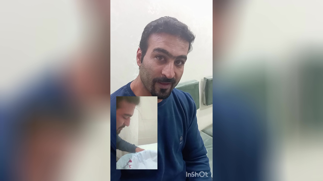 فصد پیشانی