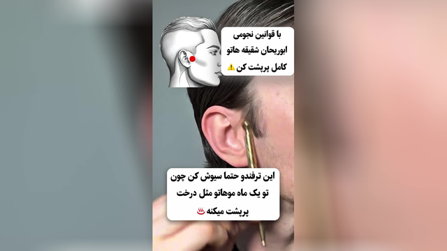 ریزش مو