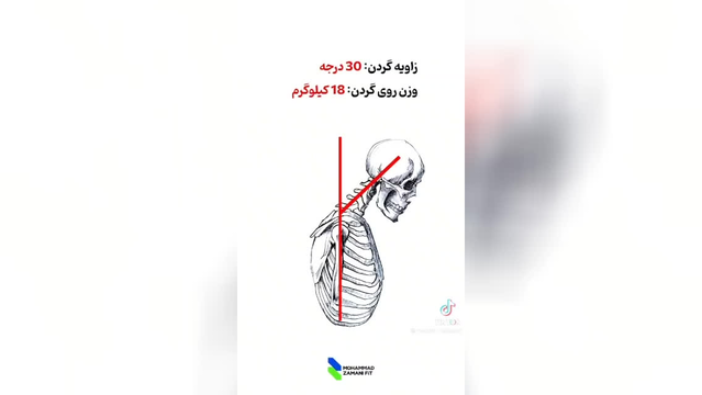 مواظب گردنت باش