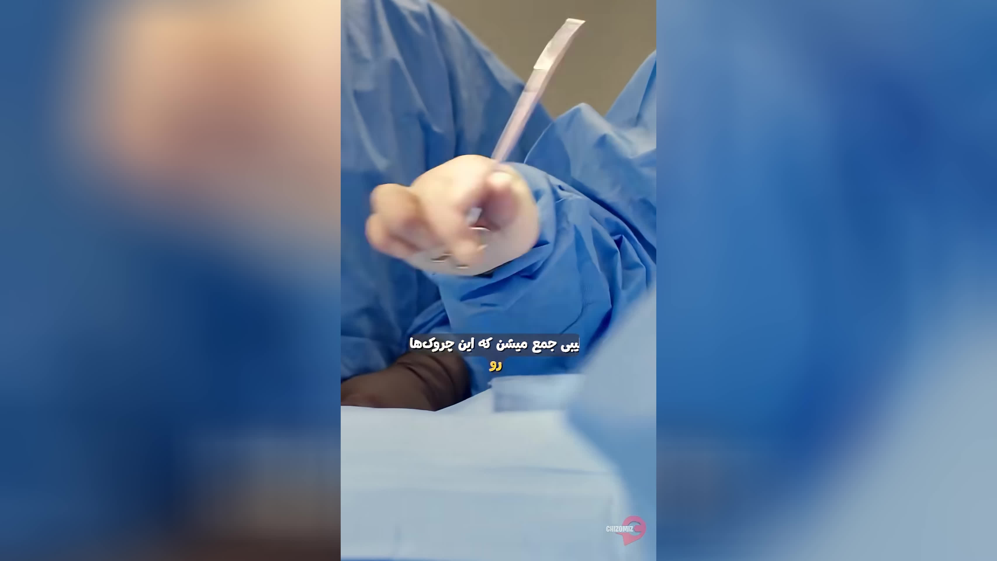 ماجرای جراحی‌های زیبایی صورت قذافی
