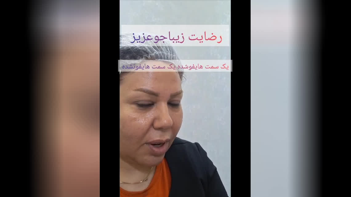 هایفوتراپی تضمینی در شیراز