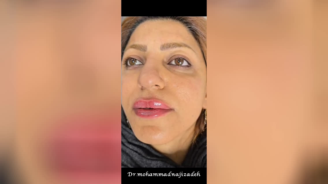 بهترین کلینیک زیبایی در شاهین شهر