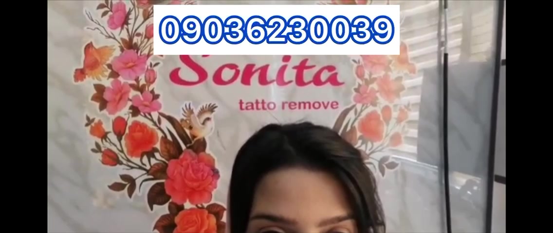 بهترین مرکز لیزر تاتو در تبریز
