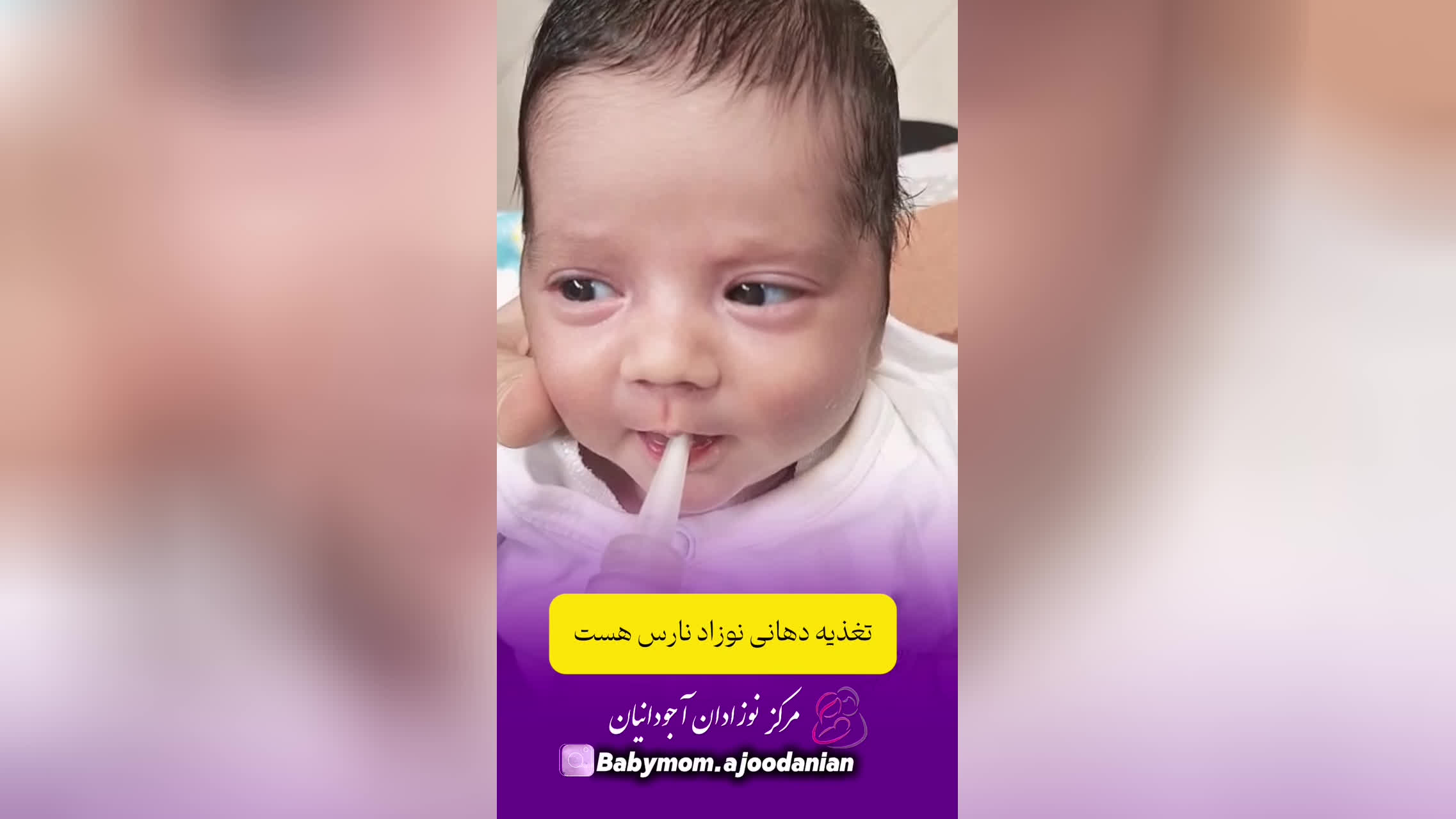 نوزاد نارس چجوری شیر میخوره؟