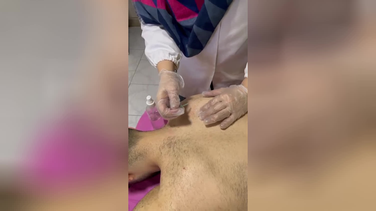 طب سوزنی کرج