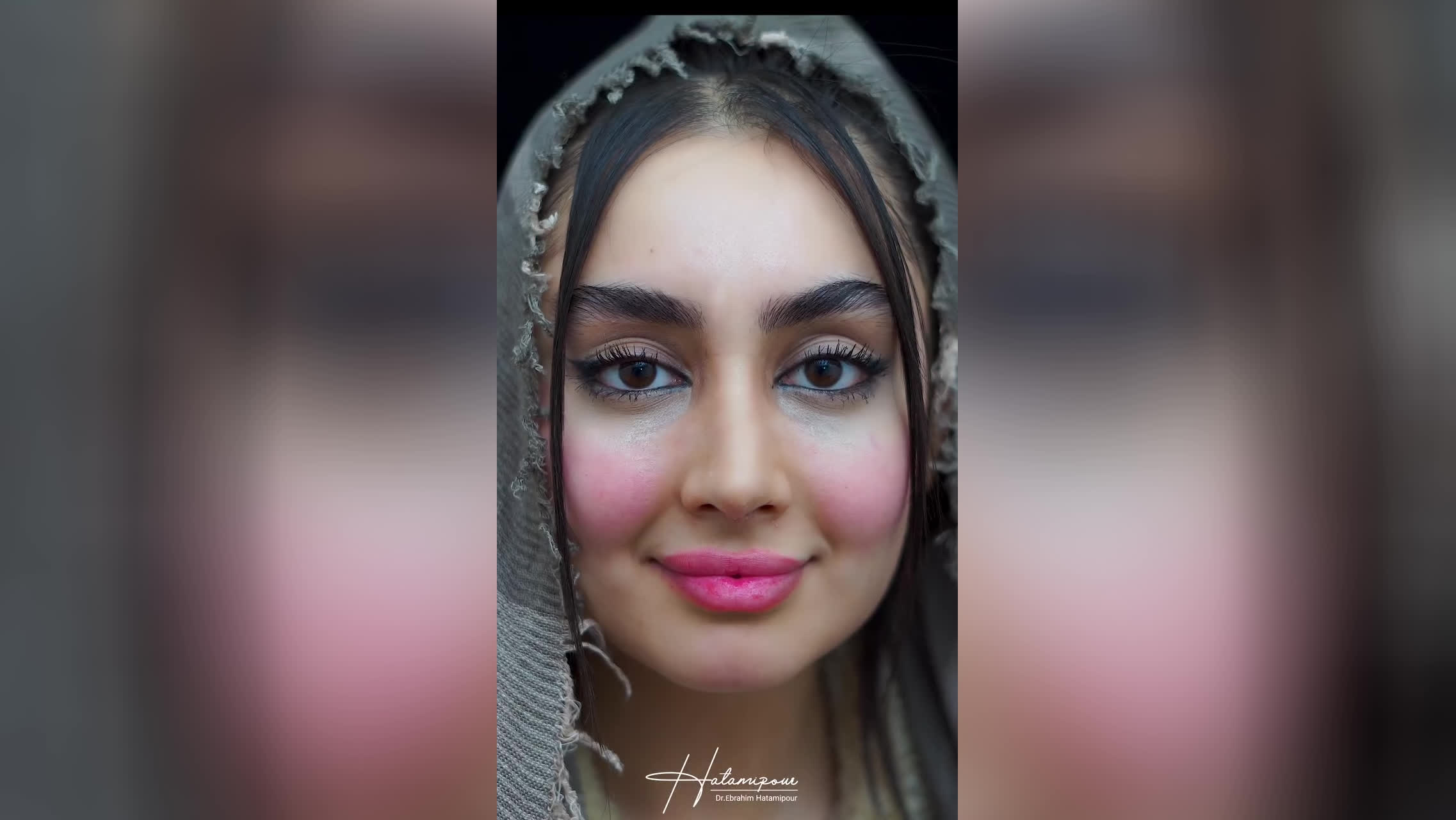 بهترین جراح بینی در شیراز