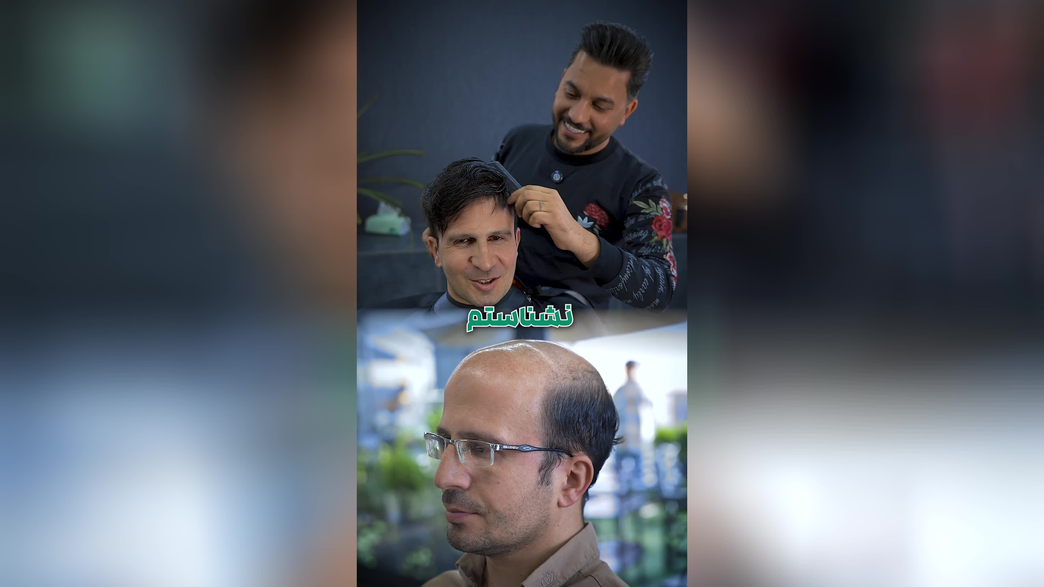 پروتز مو طبیعی بدون‌ چسب