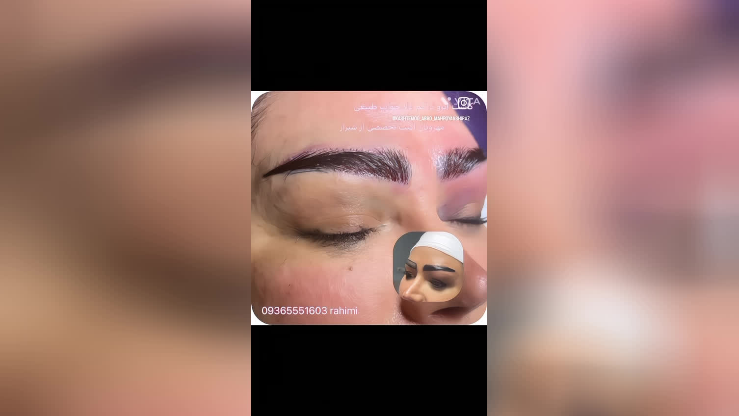 بهترین کلینیک کاشت ابرو در اردبیل